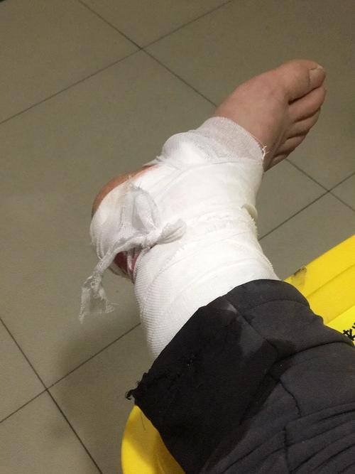 美甲意外成抢救拦路虎,女子心跳骤停引发的警示